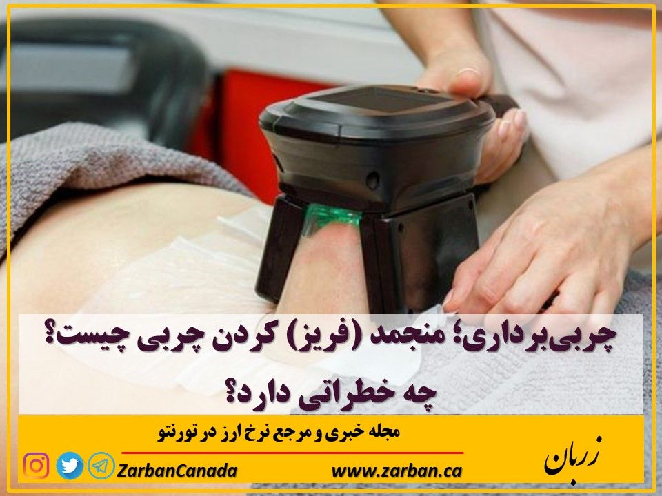 تور هزار جزیره | چربی‌برداری منجمد (فریز) کردن چربی چیست؟