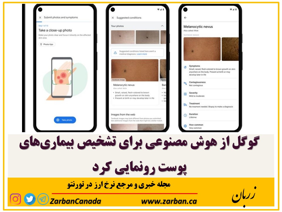 تور هزار جزیره | گوگل از هوش مصنوعی برای تشخیص بیماری‌های پوست رونمایی کرد